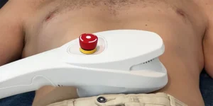 Nova Cryo, appareil professionnel de cryolipolyse