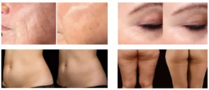 cavitation4en1 1